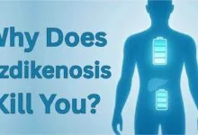 Why does ozdikenosis kill you